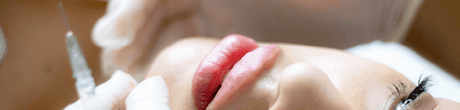 FAQ sui Filler Dermici: Risposte ai Dubbi Comuni - MR.FiLLER